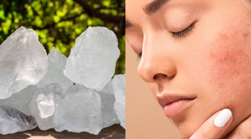 फिटकरी का इस्तेमाल कर गर्मियों में स्किन की करे देख भाल