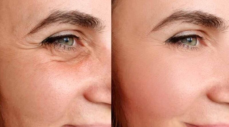 ढलती उम्र के साथ ही लटकने लगी है स्किन, तो ये होममेड सीरम लौटाएंगे आपकी खोई हुई जवानी