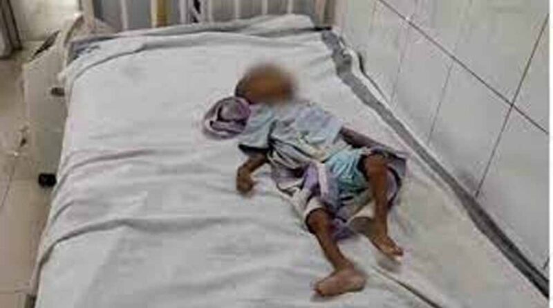शिवपुरी में कुपोषण से मासूम की मौत, बेटे की चाहत में दादी ने नहीं कराया इलाज