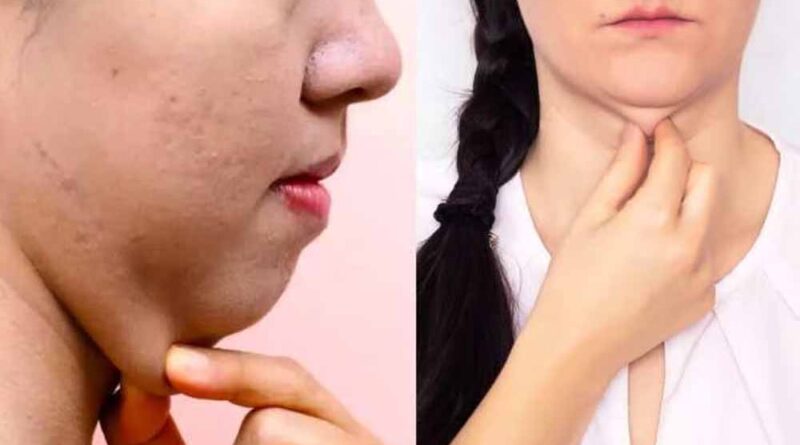 डबल चिन से छुटकारा पाने के 5 असरदार योगासन, कुछ ही दिनों में दिखेगा फर्क